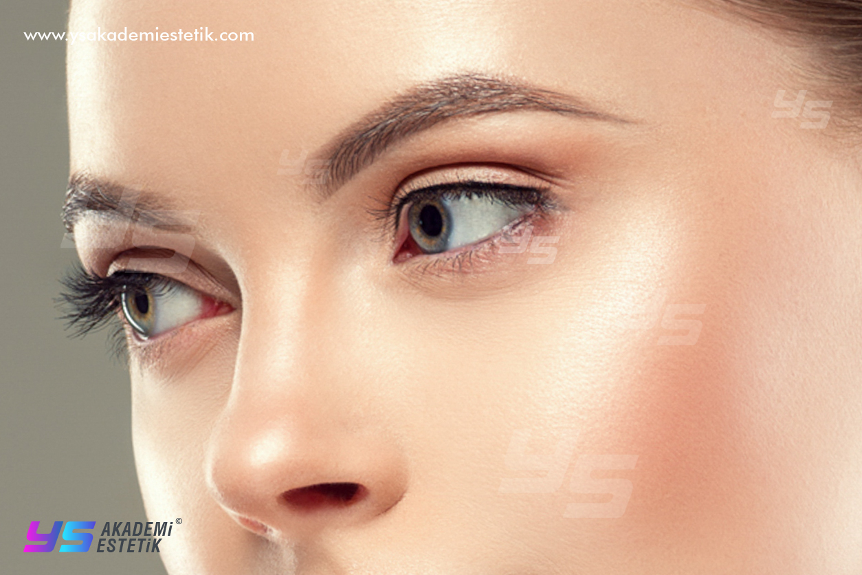 Göz altı morluk tedavisi Göz altı morlukları